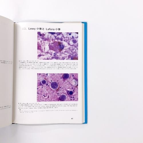 カラ－アトラス神経病理 第３版 組織病理カラーアトラス[Web付録付] 第3版 | 坂本 穆彦 |本