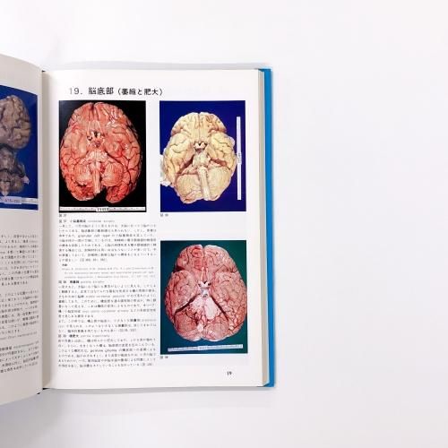 カラ－アトラス神経病理 第３版 カラーアトラス 神経病理 - ノースブックセンター販売